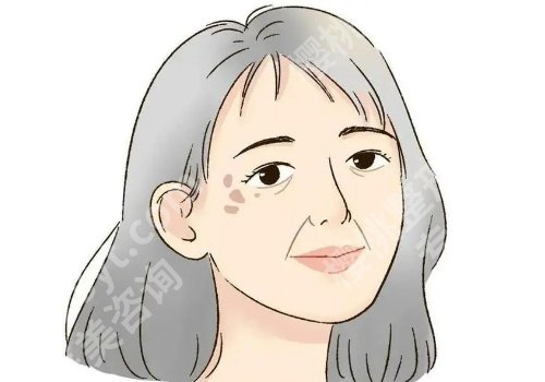 脸上长斑怎么样才能去除？都有哪些可靠的方法？
