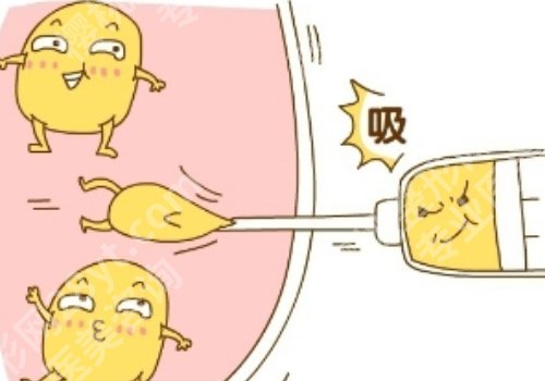 夏天如何减肥？几个减肥小方法速速get！