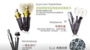 种植牙多少钱一颗2023价格表_种植牙优势、恢复时间盘点
