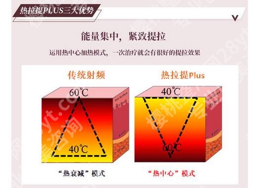 热拉提痛不痛？原理、作用范围等汇总！