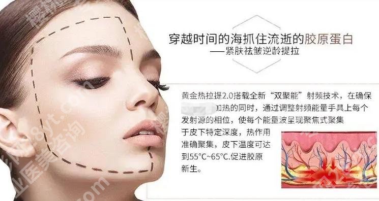 热拉提痛不痛？原理、作用范围等汇总！