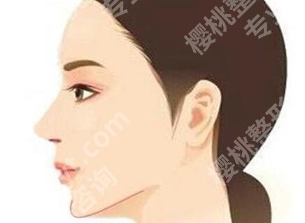 北京张笑天下颌骨手术怎么样？真人案例展示：前后差别太大了！