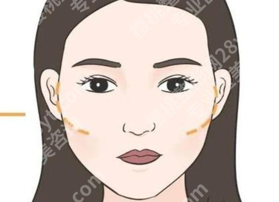 北京张笑天做颧骨手术价格贵不贵？医生基本介绍来袭!