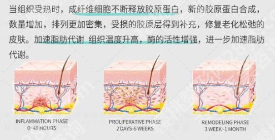 7d聚拉提多久做一次？做一次会看到改变吗？