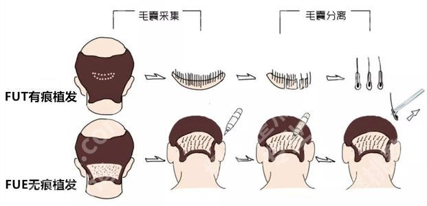 上海张久赋医生怎么样？医生擅长项目、坐诊医院等揭晓