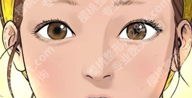 北京艺星医疗美容医院院长是谁？医院简介|双眼皮案例日记分享！