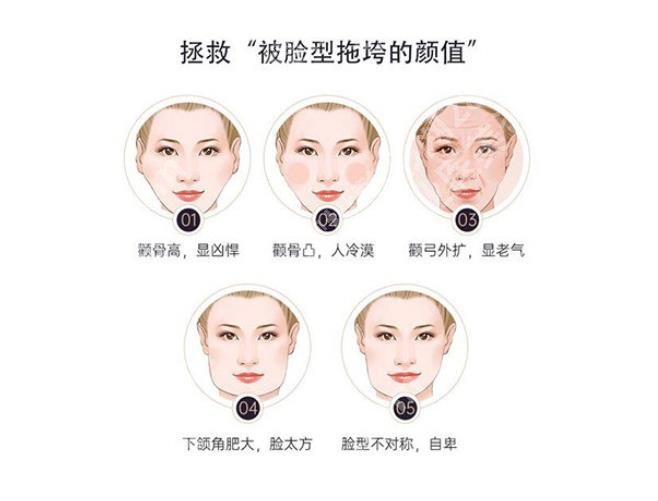 何照华做方脸好看吗？医生技术风格介绍！附全新价格表
