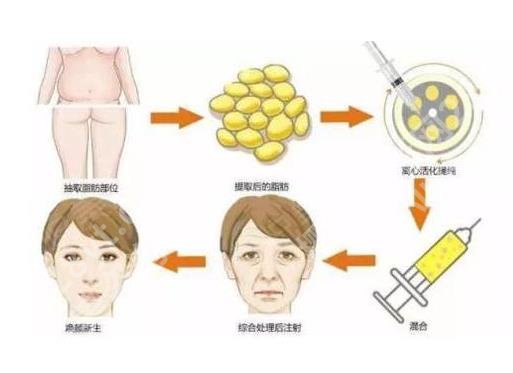 北京清木医疗吸脂医生名单:马梅生、王宇、何莹都很厉害！