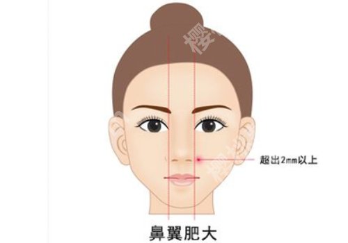 上海港华整形外科做鼻子怎么样？内附科室、医生等信息