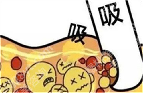 马梅生修复脂肪怎么样？附案例，在线了解