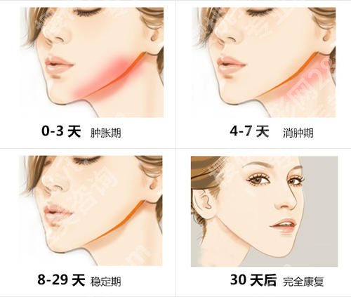 张立天简介公布，北京圣嘉新改脸型专家实力揭晓！附磨骨案例反馈