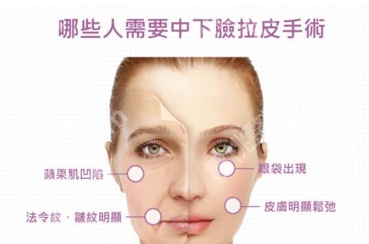 黄寅守做拉皮手术怎么样？北京加减美除皱专家实力测评！附案例解析！