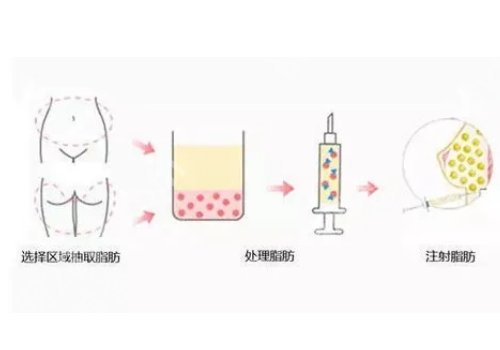 北京美莱整形医院价格表更新啦，医院信息及案例分享！