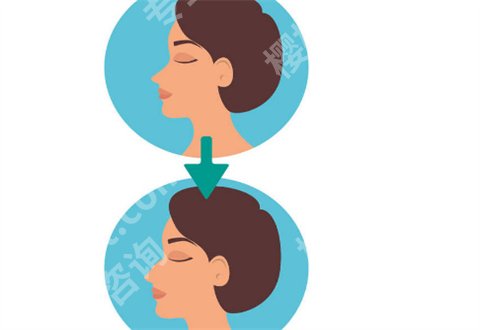 北京八大处整形鼻子挂谁的号?专家团队公布了