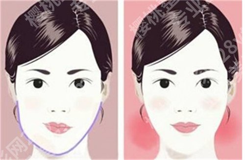 北京圣嘉荣黄大勇医德怎么样?看磨骨案例点评