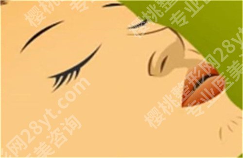 北京艺星医疗美容医院脂肪填充价格？医院口碑好