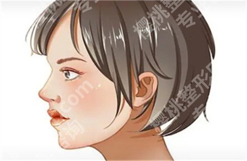 上海美之源整形门诊部做鼻子怎么样？案例美图分享