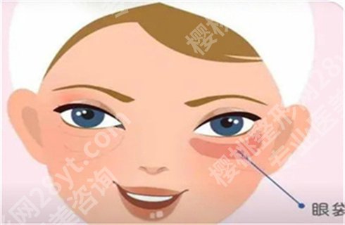 北京画美医疗美容医院眼部整形多少钱？眼部整形案例