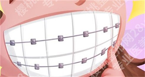 北京南区口腔医院整牙怎么样？价格表更新了