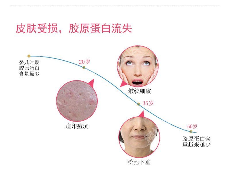 怎样修复痘坑疤痕？激光、涂抹祛疤药物、果酸换肤等，都很实用