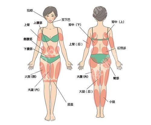 温州二医(温医二院)抽脂多少钱？腰腹1.2万元起\脸部1.4万元起\小腿1.1万元起