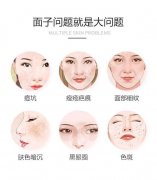 激光去痘印要多少钱？激光去痘印后反弹吗？肌肤修复指南！