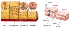 宿州第一人民医院抽脂多少钱？价格收费在1万元起！内附吸脂瘦身案例