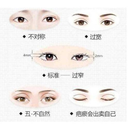 北京八大处双眼皮修复专家排名:杨明勇、宗宪磊实力解读！附案例图、价格表