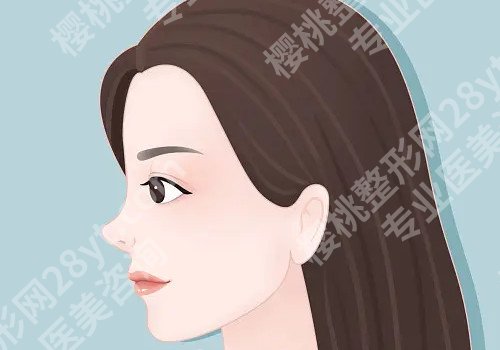 贵阳肋骨鼻子大概多少钱？手术难不难？