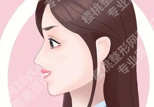 贵阳肋骨鼻子大概多少钱？手术难不难？