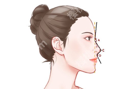 漳州假体隆鼻要多少钱?材料不同价格有区别吗?