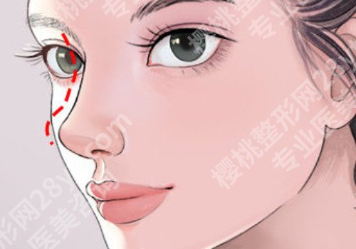 合肥肋骨鼻子大概多少钱？怎么降低风险发生的几率
