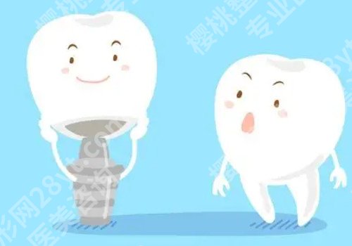 佛山种植牙术后感受分享，戳进来看！