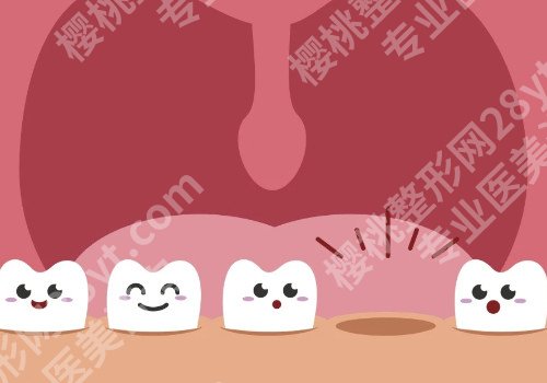 东莞种植牙案例分享，坚固度如何？