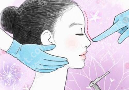 重庆假体隆鼻要多少钱?真人案例分享戳进来看!