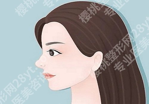 济宁假体隆鼻要多少钱？手术方案怎么定制？