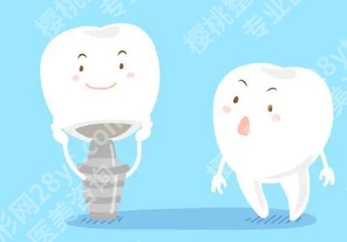 南京种植牙案例，牙齿真正得到了修复！
