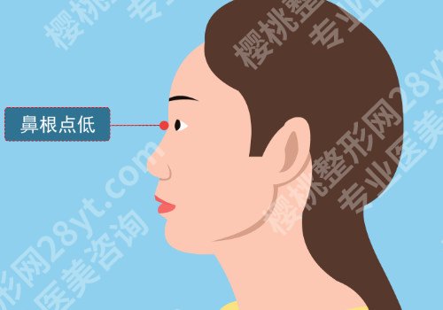 湛江假体隆鼻要多少钱？不同医院收费标准区别大吗？