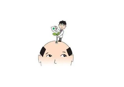 植发有用吗,可以维持多久？