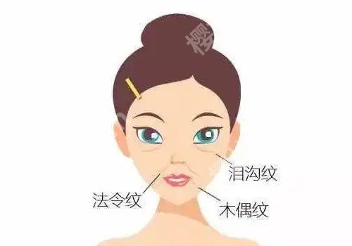 打注射除皱会老得更快吗？打注射除皱的注意事项！