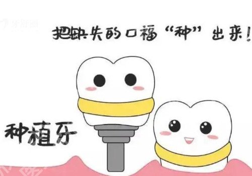 种植牙齿的寿命多少年？种植牙有哪些优点?