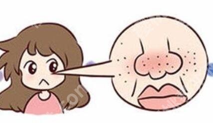 酒渣鼻的调节方法有哪些？效果好不好？快戳进来看！
