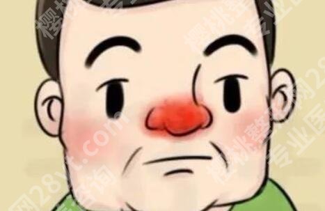 酒渣鼻的调节方法有哪些？效果好不好？快戳进来看！