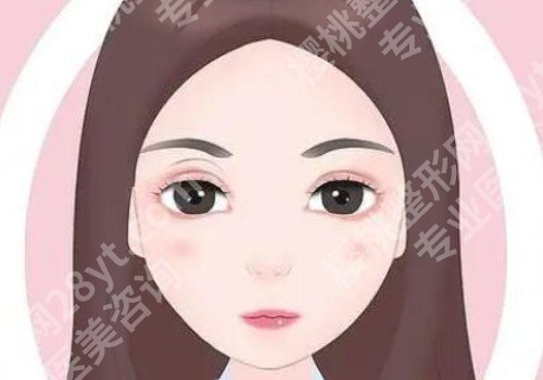 去除鱼尾纹手术多少钱呢？5家医院对比!每家都很棒！