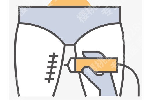 北京大腿吸脂手术疼吗？真实案例过程分享！术后恢复注意事项！