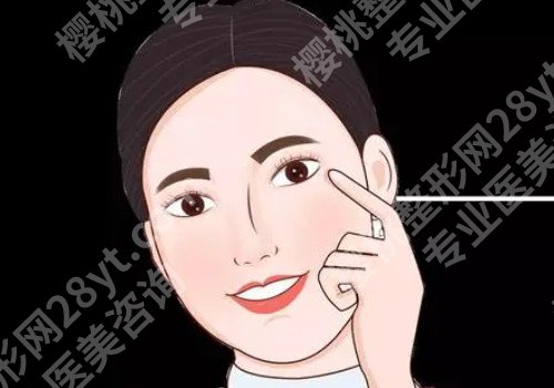 肿眼泡抽脂前后对照图，真实案例分享！恢复过程揭秘！