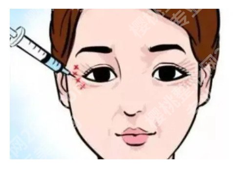 肿眼泡抽脂前后对照图，真实案例分享！恢复过程揭秘！