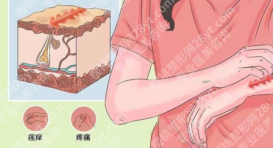 九院武晓莉需要提前几天预约？手术做的怎么样？疤痕疙瘩修复案例一览