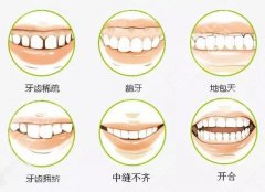 北京盖德口腔门诊部牙齿矫正价格多少钱？8000～60000元起！附案例