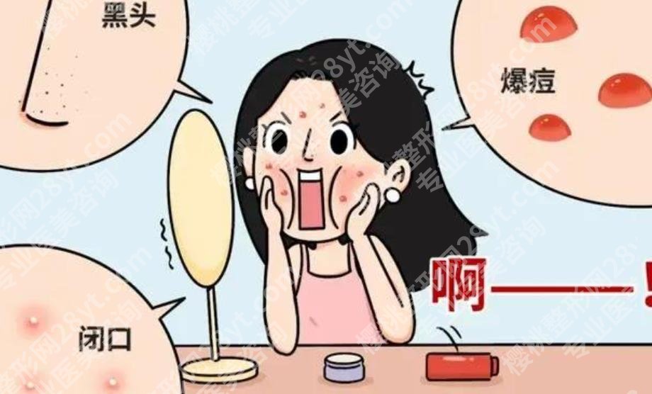 湘潭中心医院美容科祛痘好吗？你想了解的都在这里！